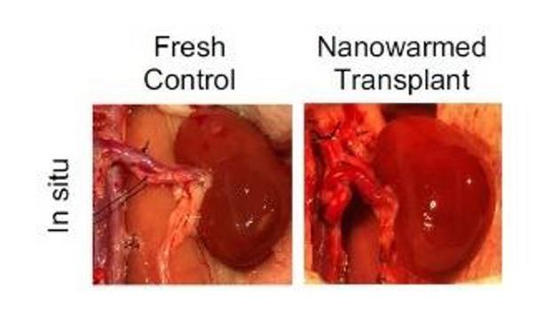 An image of a fresh control rat kidney inside a rat