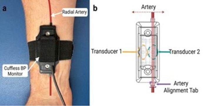 Figure 1. The photo depicts: (a) a cuffless blood pressure monitor placed on the wrist with either transducer on or near the artery, and (b) a diagram showing placement of transducers along with relative alignment. 