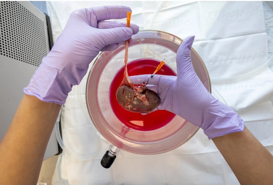 A pig kidney that had been removed from its host and frozen 10 days earlier was thawed and prepared for a transplant experiment at Massachusetts General Hospital.