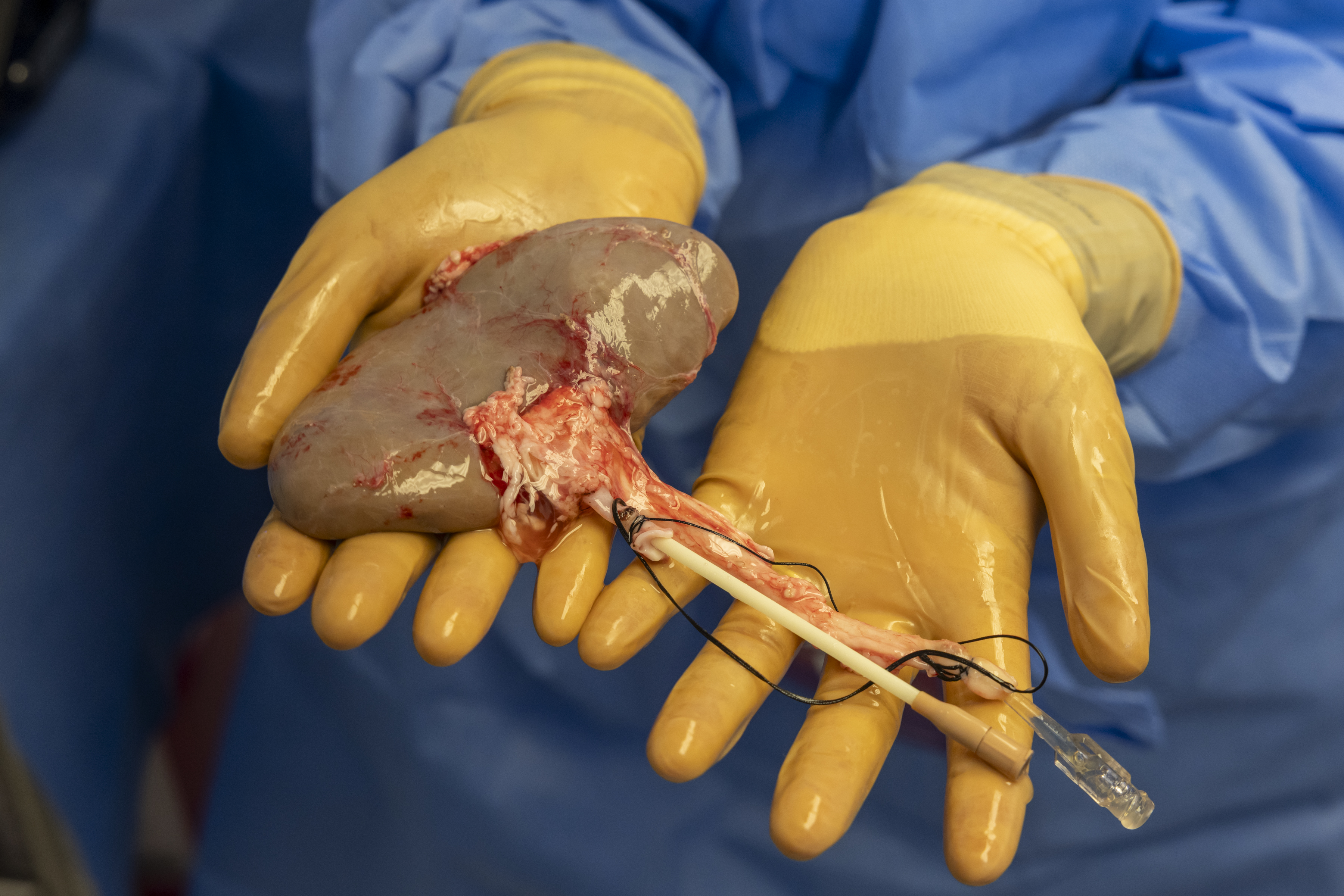 Pig kidney prepared for freezing