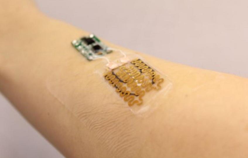 A smart bandage with wound covering component (right), containing sensors and a drug carrier, and a microprocessor (left) that interprets sensor input developed by ASSIST ERC.