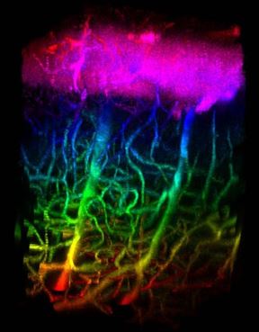 Figure 2. Reverberation 2PM imaging of in vivo mouse brain vasculature. (Credit: CELL-MET)