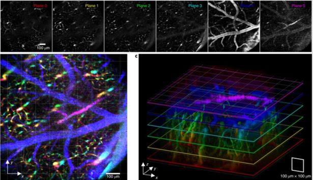 Figure 1. CELL-MET's 6-plane vasculature imaging using reverberation microscopy. (Credit: CELL-MET)