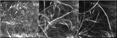 Figure 1. Line-scan Multi-Z microscope images: Example of simultaneous 3-plane imaging (sample: aspergillus).