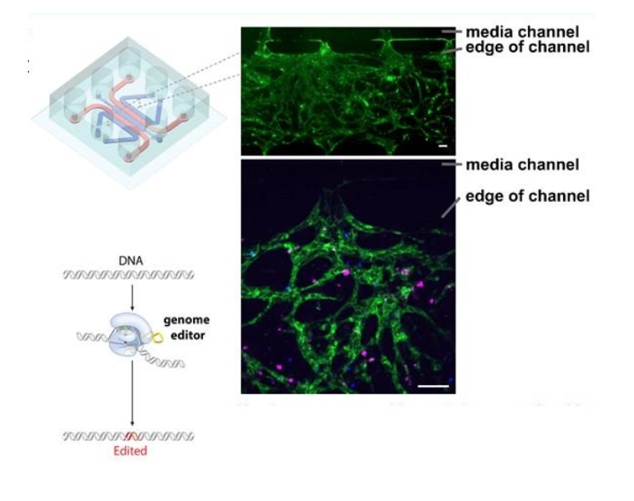 OMI reveals a bone marrow chip created by CMaT researchers. The chip contains a permeable vascular network of endothelial cells (green; top) with an editable coculture network of primary multiple myel